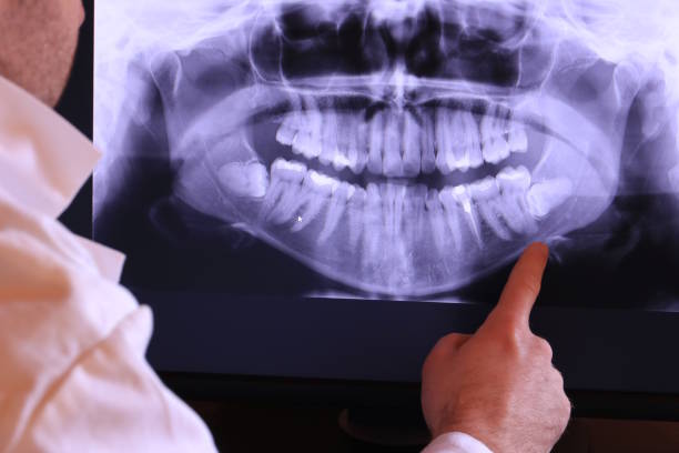 Best Broken or Cracked Tooth Emergency Dentist in Hampton, MD