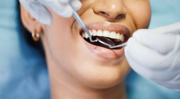 Best Emergency Dentist for Knocked-Out Tooth in Hampton, MD