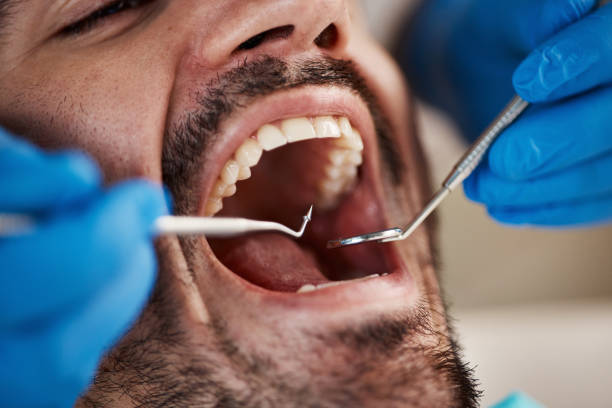 Best Urgent Dental Care for Toothache in Hampton, MD